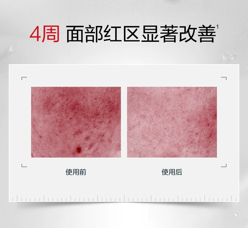 薇诺娜屏障修护柔肤水深层补水修护屏障爽肤水120ml