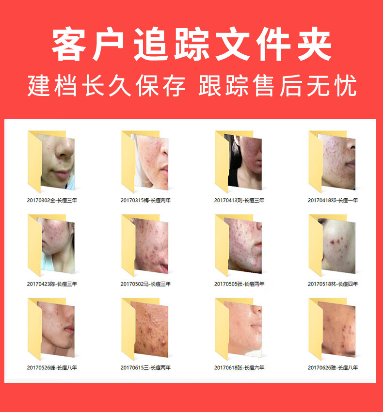 RYDEEN 壬二酸祛痘膏水杨酸净痘膏平衡痘肌痘坑熬夜助手学生党平价 三支装