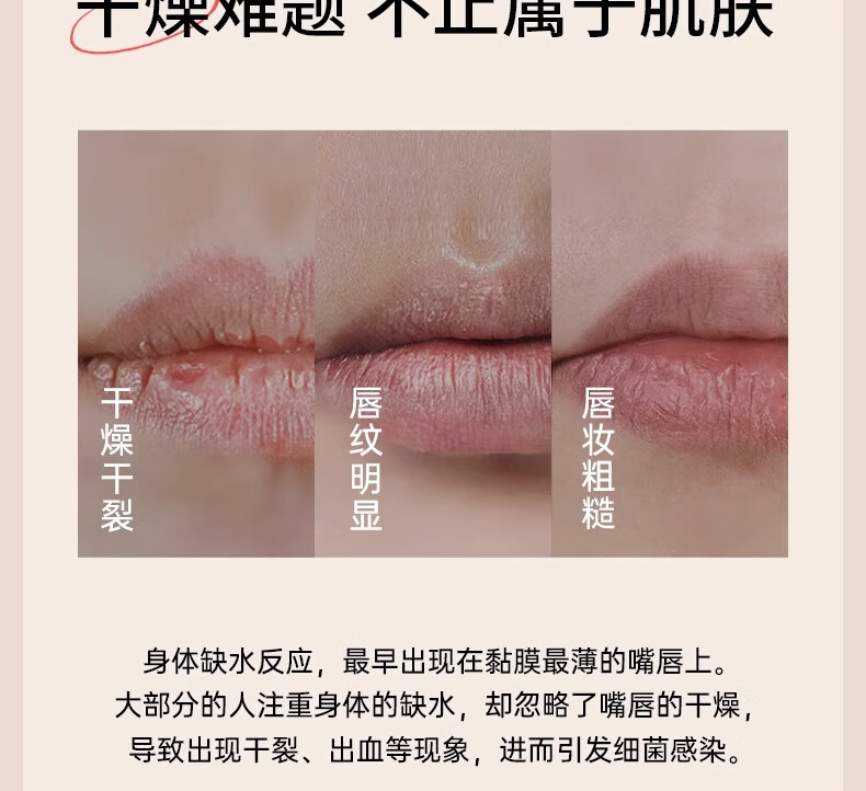 ORGINESE咖啡因唇膜霜去死皮淡化唇纹润唇膏唇部护理唇炎女保湿滋润防干裂