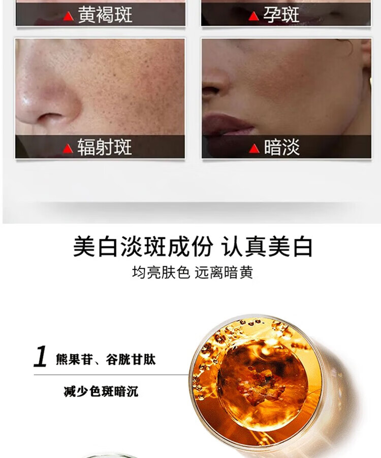 白云山星群 美白祛斑霜溶斑断黑霜淡化斑老年斑雀斑黄褐斑男女士去斑产品30g
