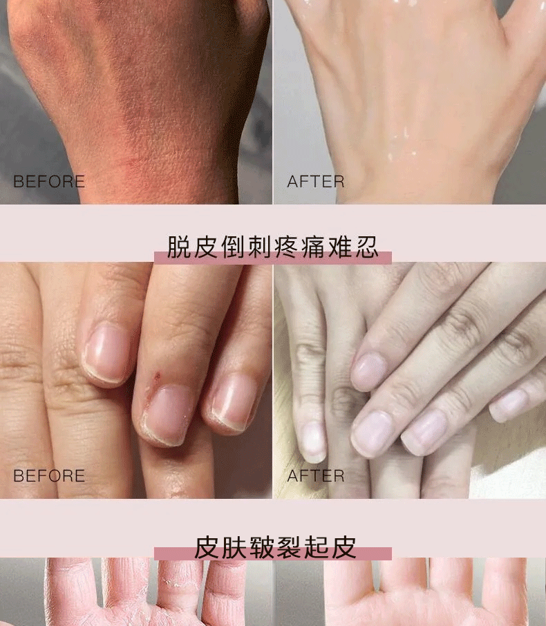 南京同仁堂牛油果护手霜秋冬男女士滋润手霜防干裂皲裂手部倒刺护理100g