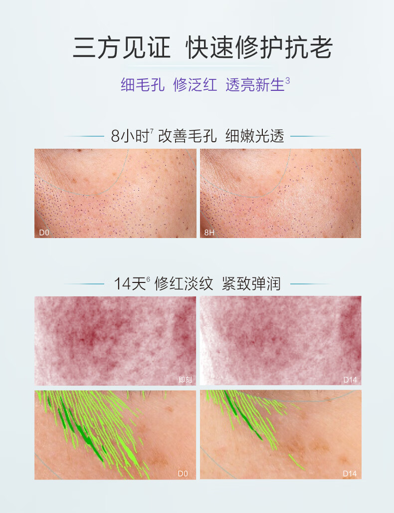 自然堂小紫瓶精华第五代 凝时修护精华液50ml 超极酵母喜默因女神节礼物