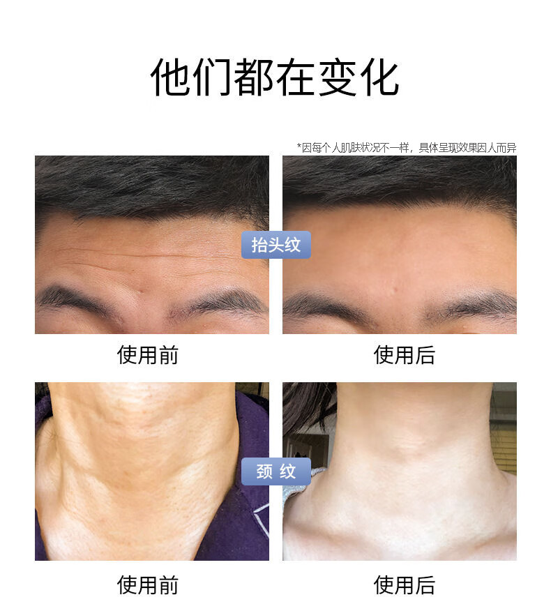 白云山星群六胜肽抗皱面霜胶原蛋白重组霜补水紧致保湿淡化面部细纹50g