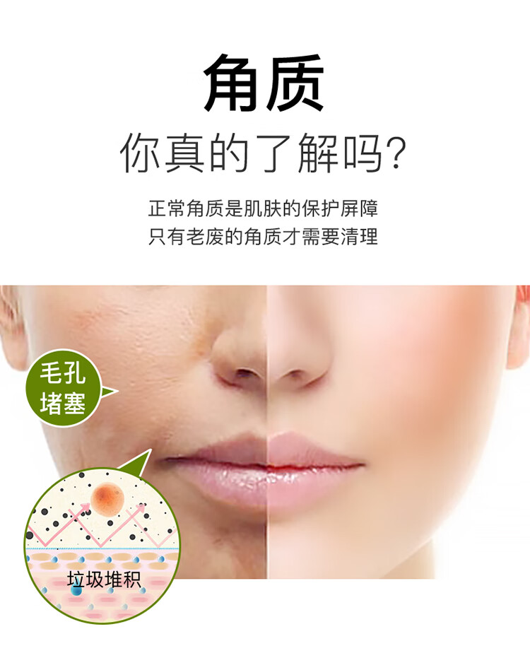 形象美柠檬去角质素120g（面部温和去角质啫喱 全身去死皮 深层清洁 身体磨砂膏 洁面洗面 男女士护肤 ）