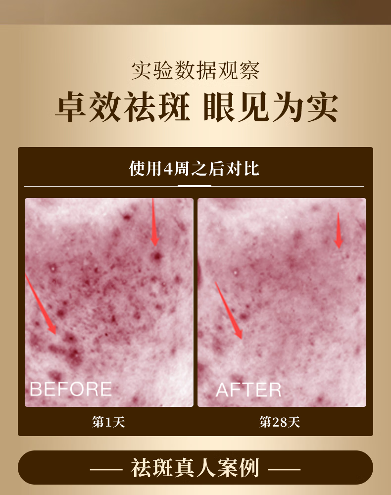 南京同仁堂祛斑霜美白霜提亮肤色男女士淡化黑色素面霜50g