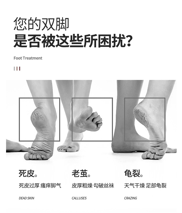 优家UPLUS 双面粗细磨砂磨脚器搓脚板（足部去角质去脚皮去死皮去老茧 脚底护嫩足工具磨脚板磨脚石）