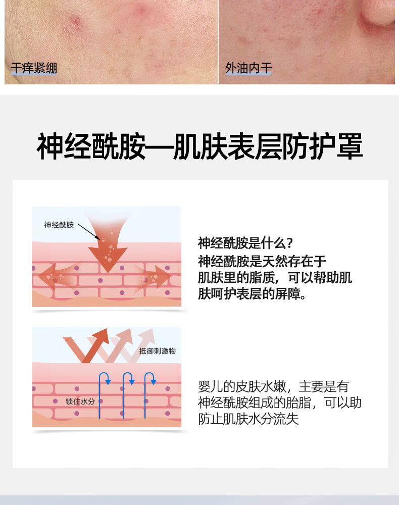 芳丹薄罗去淡化敏红丝呵护复血肤护肤品神经酰胺面霜男女通用50g