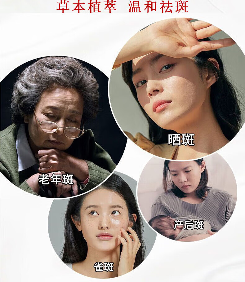 广药白云山祛斑霜美白去斑淡化黑色素溶斑霜30g