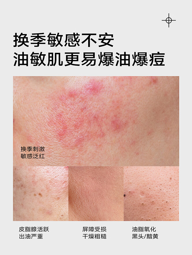 优理氏（UNES）清透控油水乳护肤品套装 补水保湿 抗痘祛痘 平衡水油 祛粉刺 水120ml+乳100ml