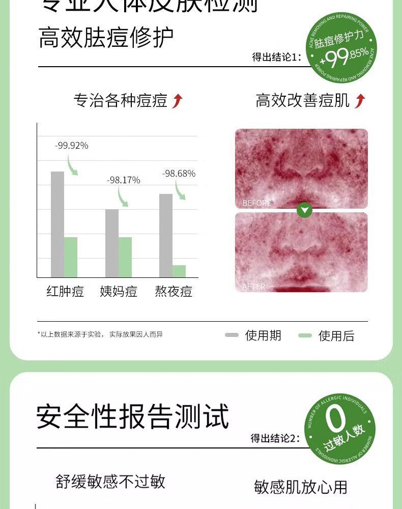 德德维芙壬二酸祛痘膏痘印和痘坑去青春痘学生去黑头粉刺修凹洞男女凝胶膏