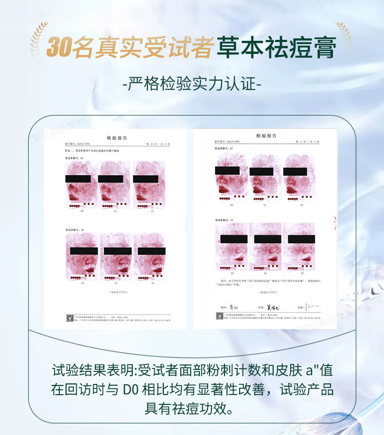 同仁堂祛痘膏淡化痘印痘坑修复男女士改善粉刺闭口去痘痘和痘印