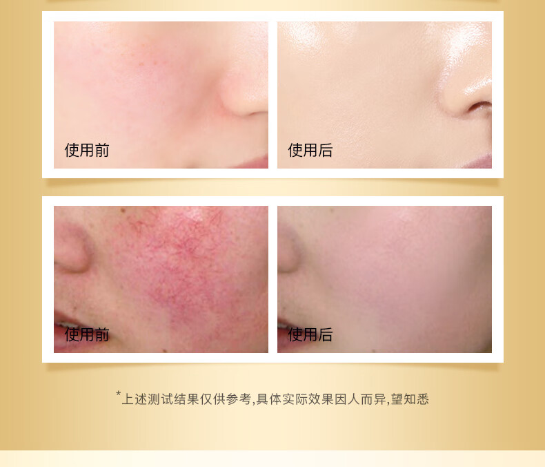 南京同仁堂 百幽草红血丝寡肽修护精华液敏感肌面部精华增厚角质层肌肤干痒补水保湿舒缓精华水100ml