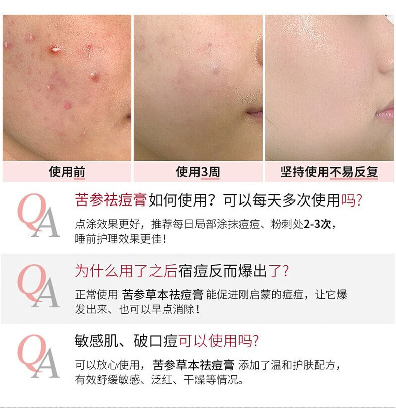 白云山 祛痘膏去痘疤亮肤青春痘30g