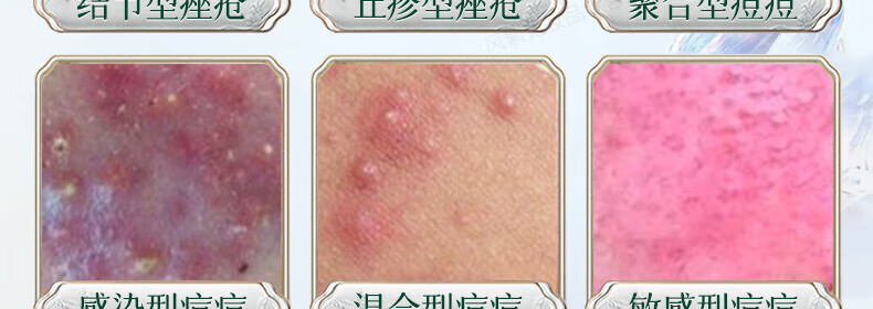 同仁堂祛痘膏淡化痘印痘坑修复男女士改善粉刺闭口去痘痘和痘印