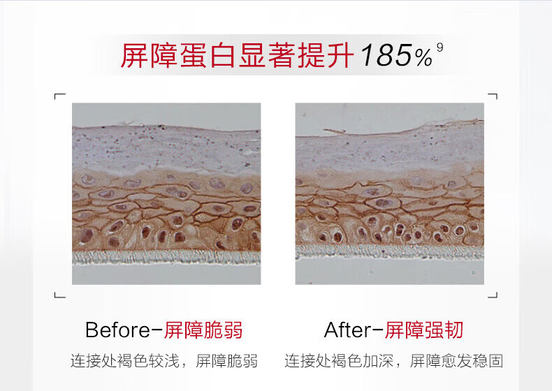 薇诺娜（WINONA）舒敏保湿特护霜50g敏感肌补水滋润面霜