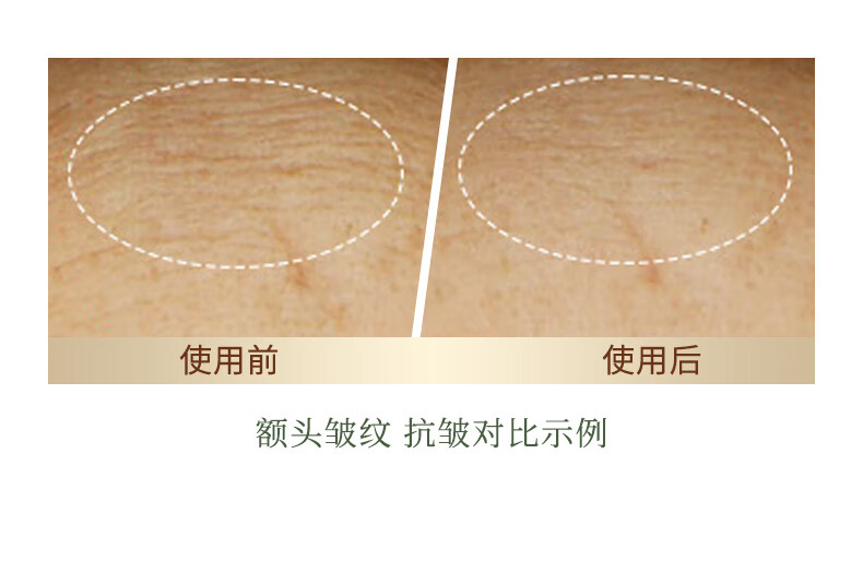 林清轩山茶花修护精华油4.0升级10ml 内修外抗以油养肤淡纹小皇瓶护肤油