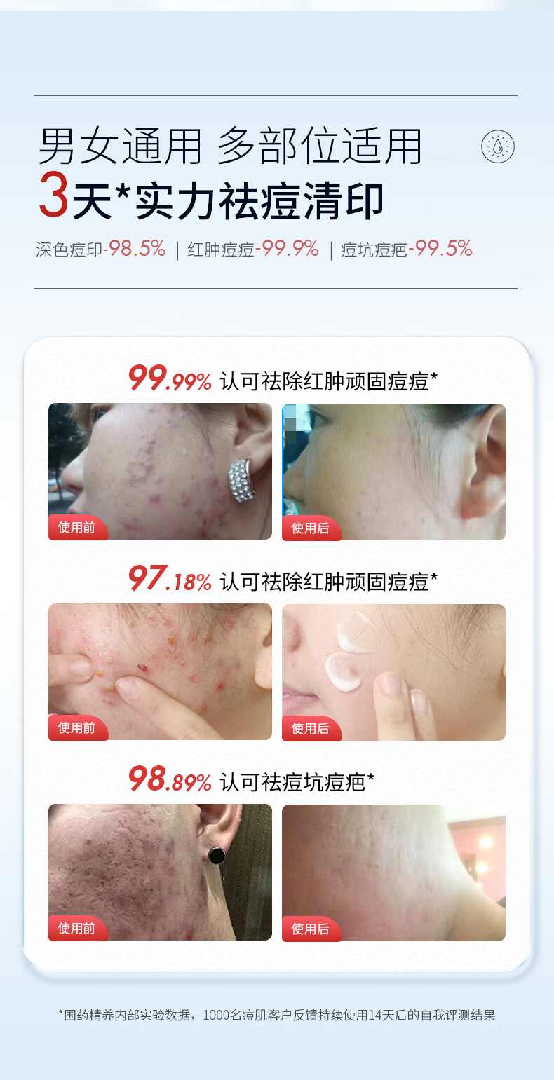 国药精养祛痘膏去痘疤痘坑痘印修护红肿闭口粉刺痘肌净肤青春痘40g