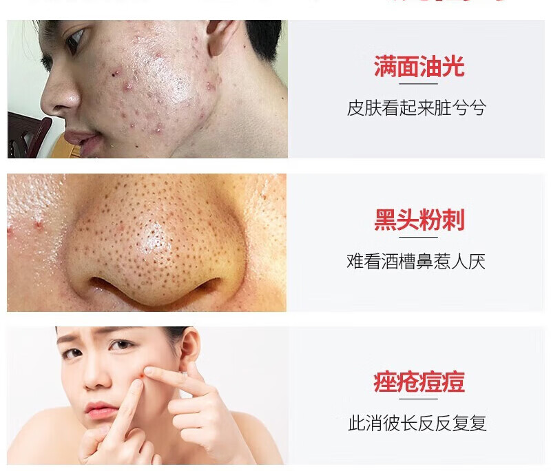 同仁堂洗面奶男女深层清洁收缩毛孔黑头痘坑粉刺闭口痘痘和痘印150g