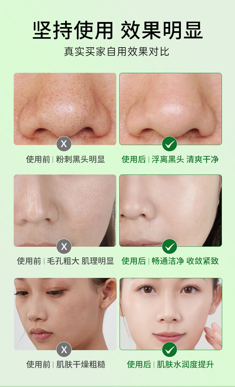 REIHO微酸积雪草小气泡面膜去黑头收缩毛孔自发泡控油清洁嘿头补水泥膜