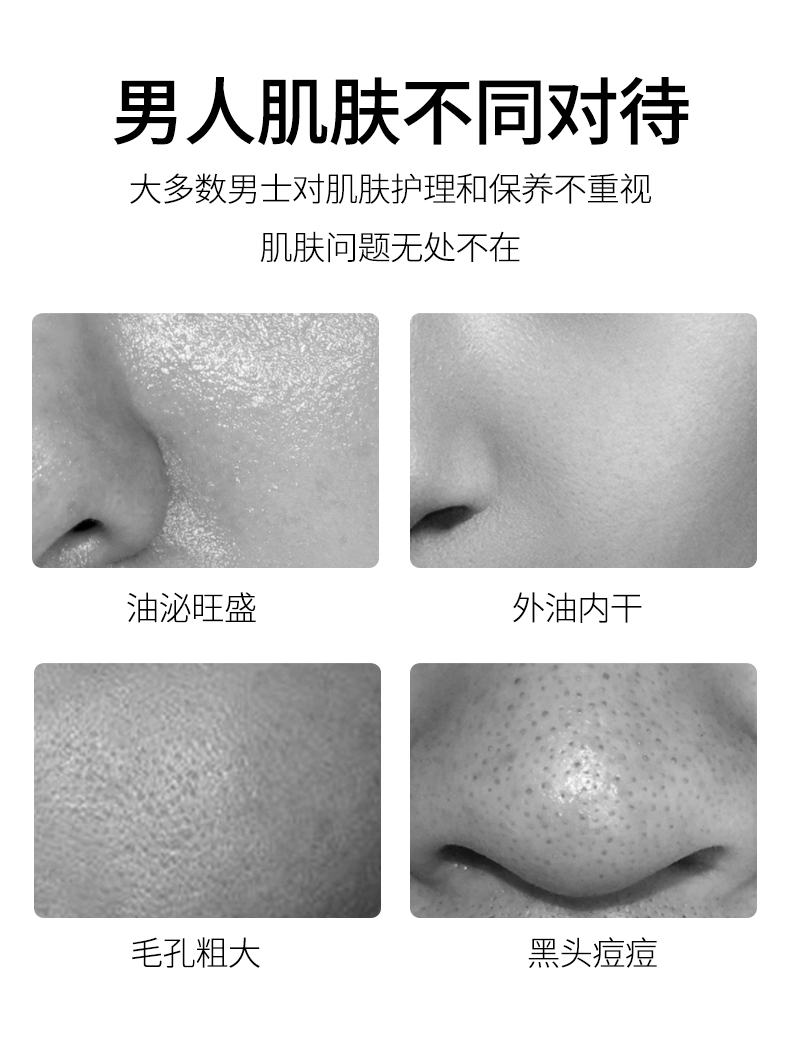 蒙度士(MdoC)男士专用控油礼盒三件套(爽肤水+精华乳+面膜)(韩国进口护肤品送男友套装油脂调理控油保湿乳液)
