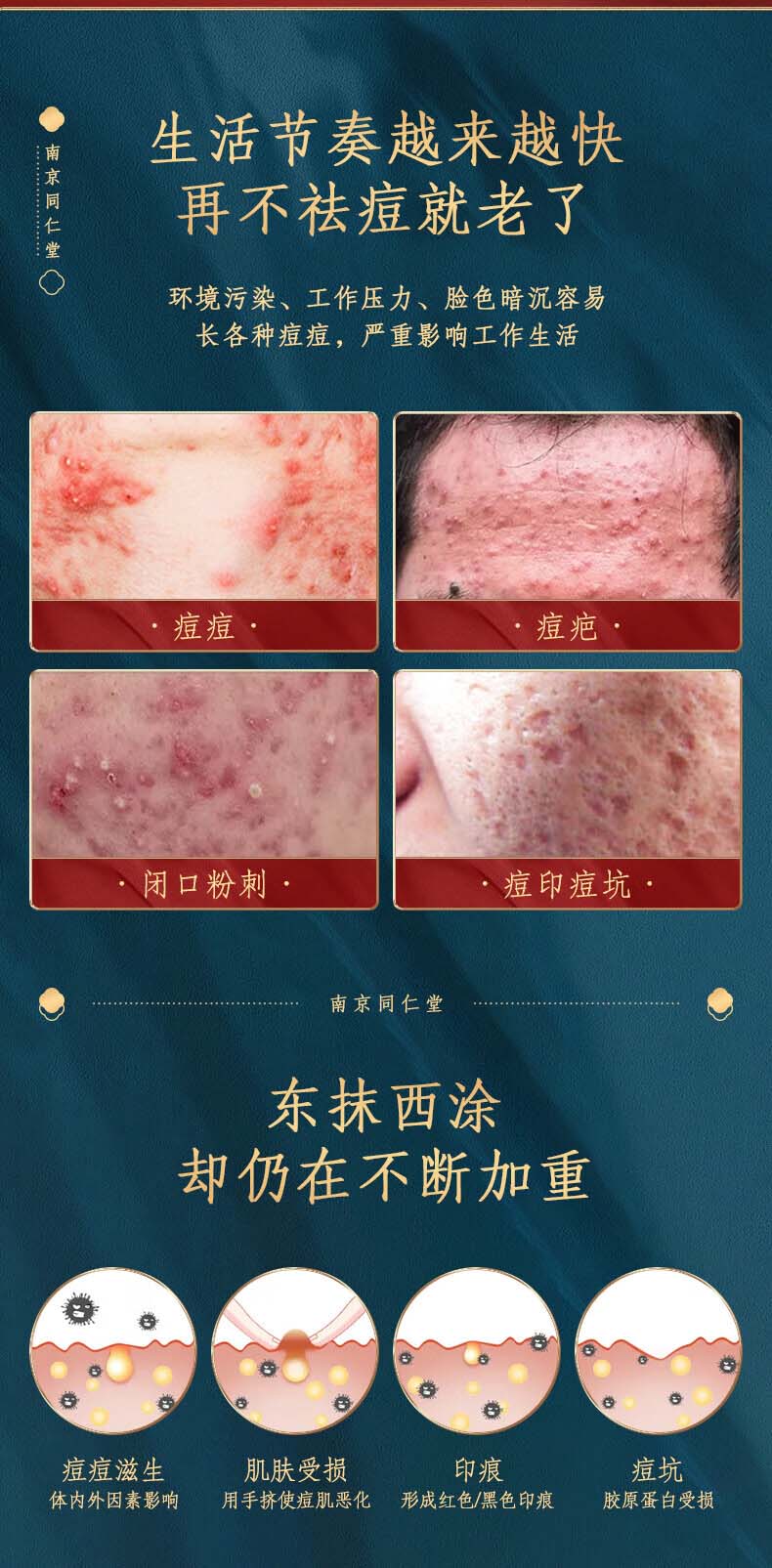 百幽草南京同仁堂水杨酸祛痘膏痘印淡化痘印痘坑修复学生男女青春痘30g