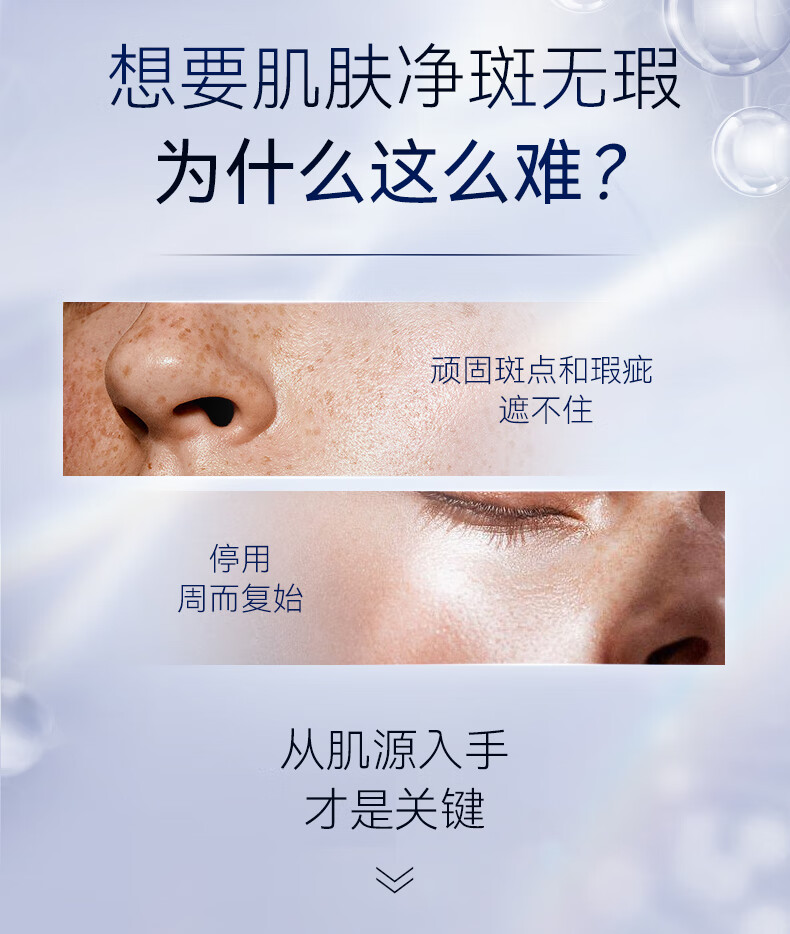 RSAS祛斑美白精华液 雀斑晒斑黑斑黑色素提亮肤色 美白精华液