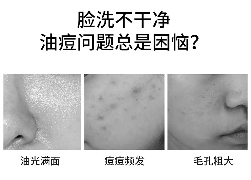SNOOPY史努比中学生洗面奶祛痘控油氨基酸洁面乳100g青少年高中生男女用