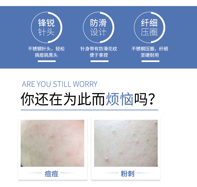 优家UPLUS 双头不锈钢防滑暗疮针粉刺针 细胞夹黑头针粉刺夹痘痘针