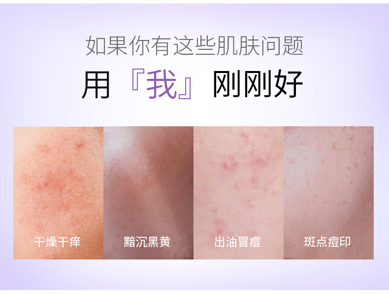 京润珍珠美白修护面膜5片 提亮肤色改善干痒舒缓保湿面膜贴 敏感肌护肤品