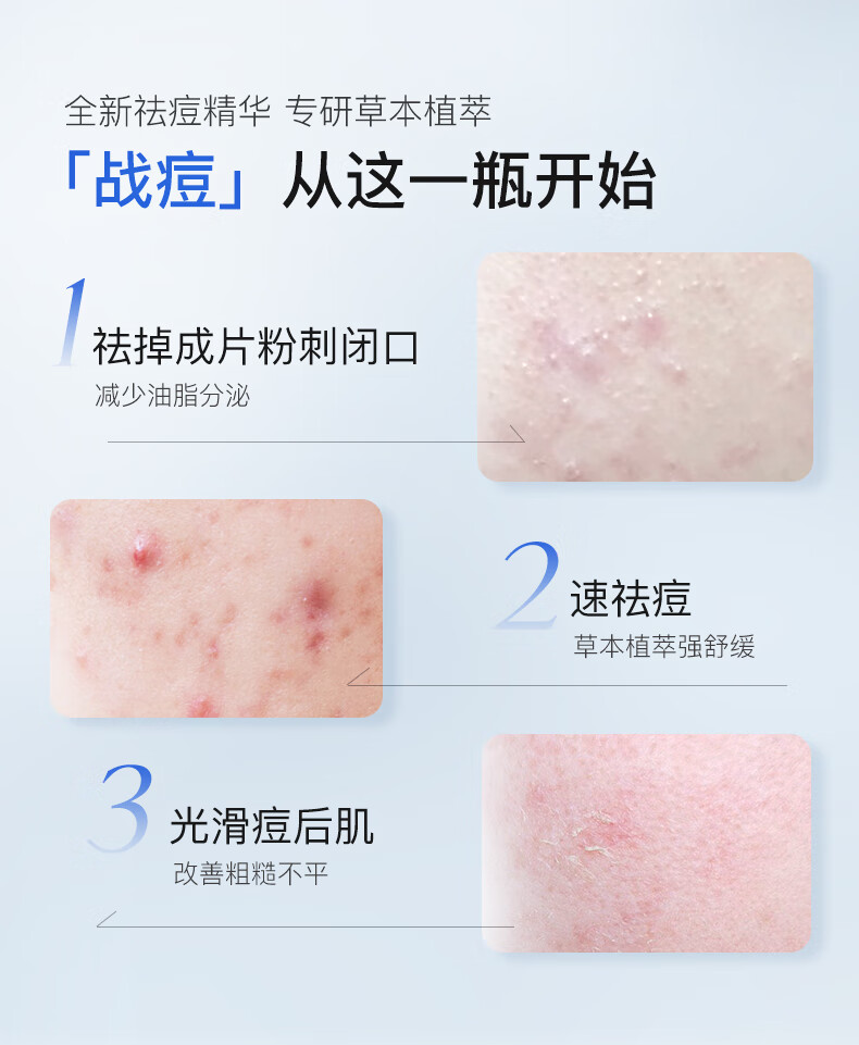 比度克（BeDOOK）BEDOOK比度克祛痘舒缓精华液 祛痘精华液