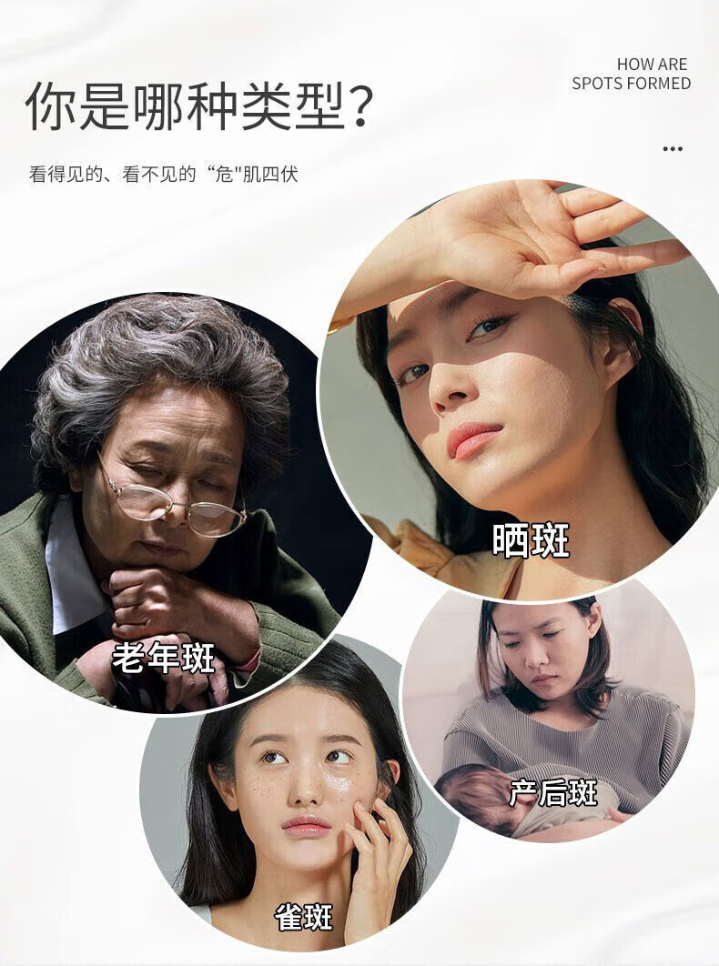 白云山星群 美白祛斑精华液溶斑油补水保湿提亮肤色烟酰胺祛斑产品100ml