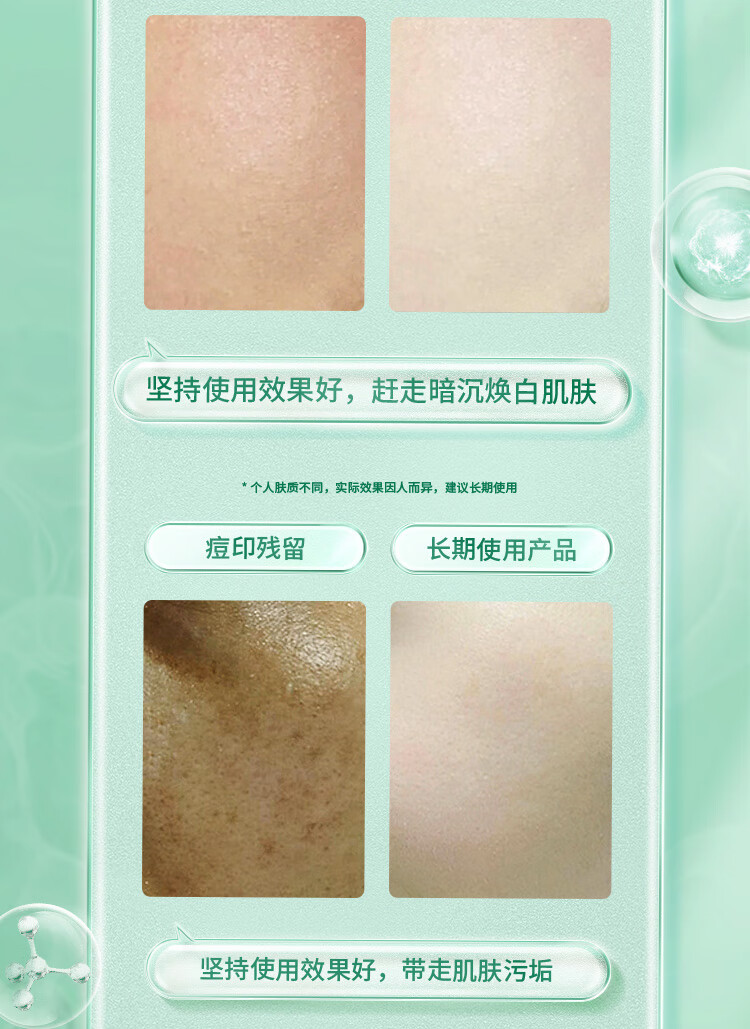 初霜控油除螨虫深层去污清洁面乳收缩小毛孔补水保湿祛痘印黑头洗面奶 银色装 (氨基酸配方.温和不刺激) 每瓶180g ( 控油除螨率达99% )