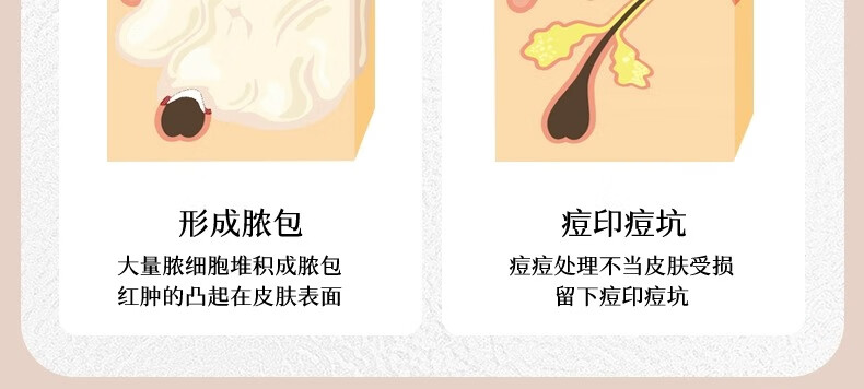 ORGINESE欧橘水杨酸果酸水滴精华液熬夜刷可搭祛痘淡化痘印20ml情人节