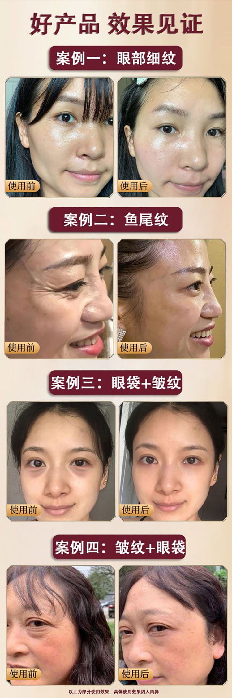 北京同仁堂抗皱眼霜淡化细纹大眼袋黑眼圈提拉紧致男女通用热熔霜 一盒装30g