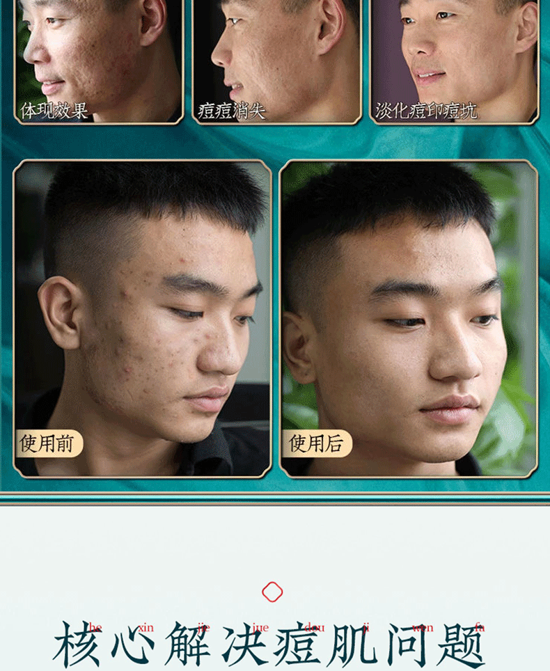 南京同仁堂祛痘膏淡化痘印痘疤痘坑呵护痘肌青春痘
