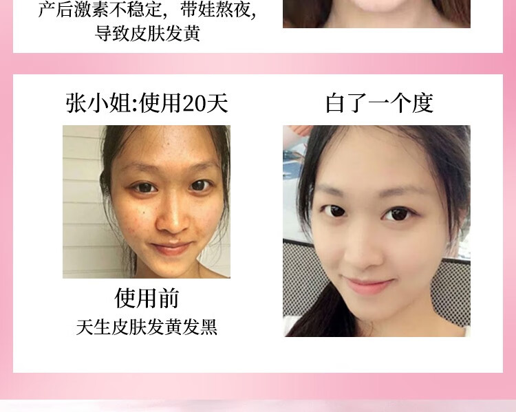 RUTBELL美白祛斑精华油提亮肤色淡化晒斑雀斑黄褐斑老年斑面部精华液 1瓶【建议按疗程购买】