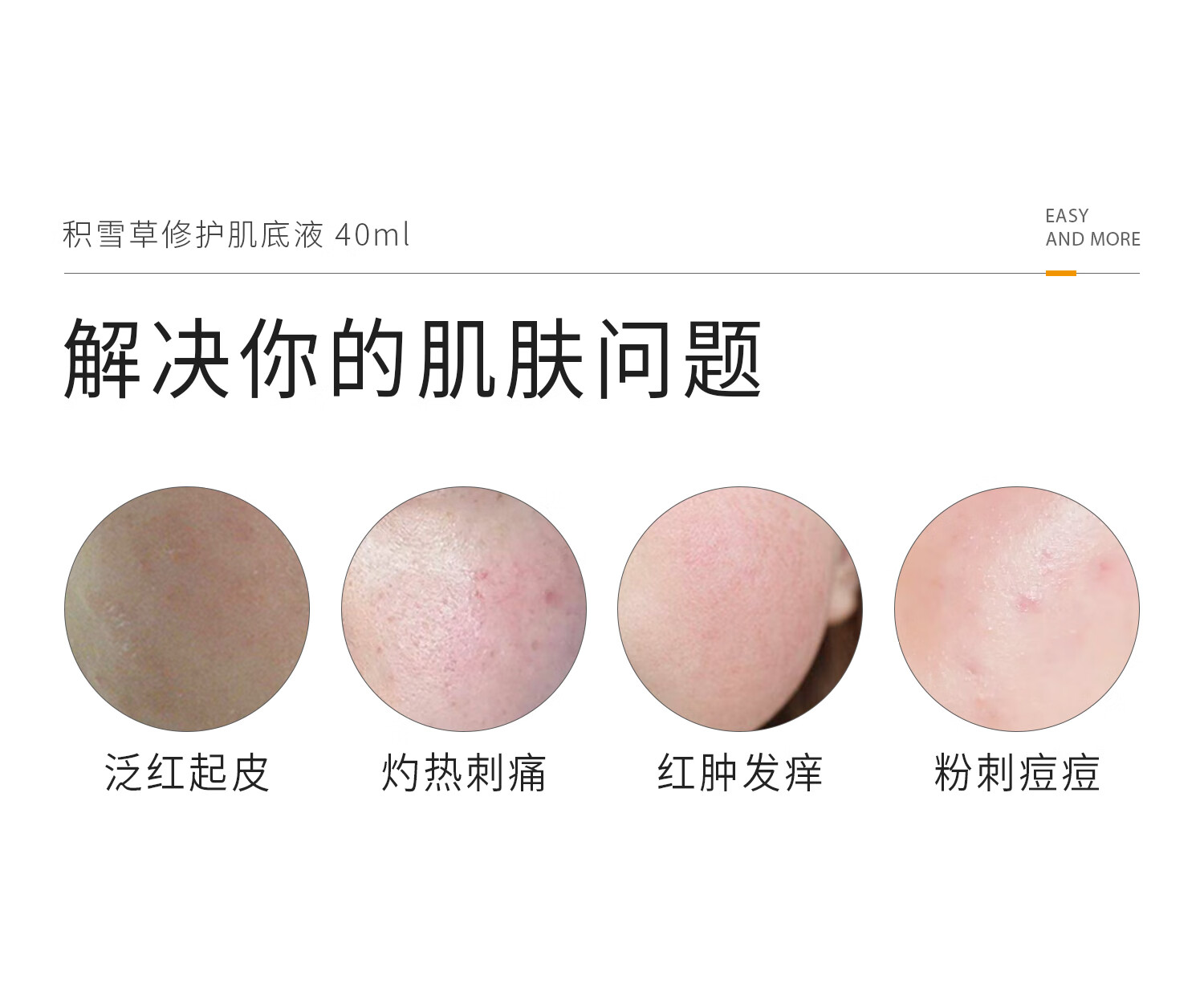 934【直播专属】积雪草修护舒缓肌底液精华敏感肌男女适用 40ml