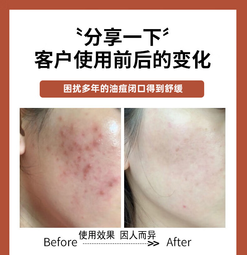 仁和药业 苦参氨基酸洗面奶男女士通用控油抗痘洗面奶黑头敏感肌肤收缩毛孔深层清洁温和洁面乳500ml