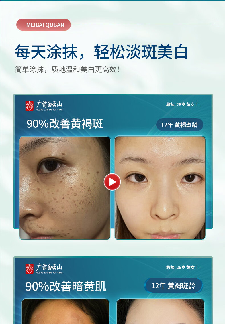 白云山祛斑霜美白去斑男女士雀斑黄褐斑晒斑妊娠斑淡化黑色素溶斑霜50g