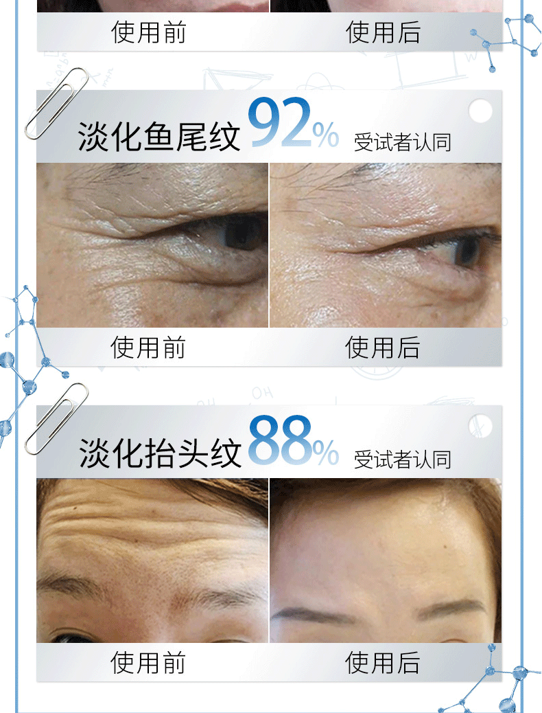 人仁和匠心 抗皱精华液透明质酸钠玻尿酸精华液 淡化细纹补水保湿锁住水分收缩毛孔提拉紧致200ML