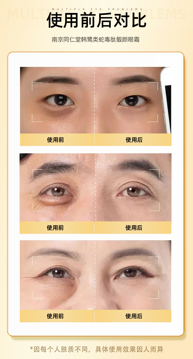 南京同仁堂类蛇毒眼霜大眼袋黑眼圈淡化细纹皱纹提拉紧致男女士通用50g
