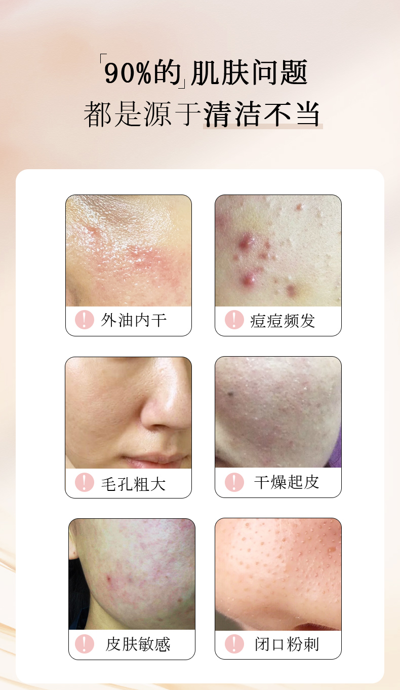 浅香（ASAKA）洗面奶氨基酸洁面乳男女去角质去黑头洁面膏100g敏感肌