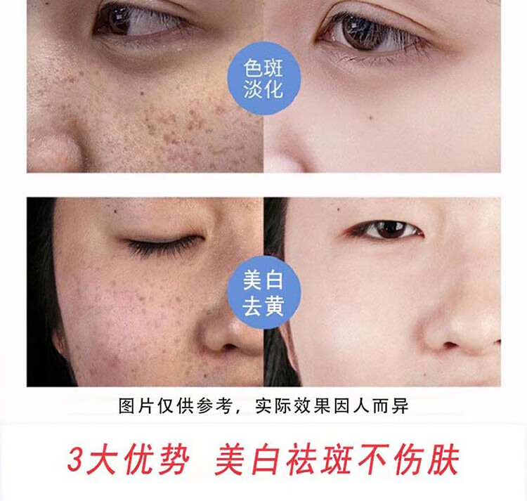 广药白云山美白祛斑精华黄褐斑老年斑雀斑溶斑油去黄淡化黑色素烟酰胺100ml