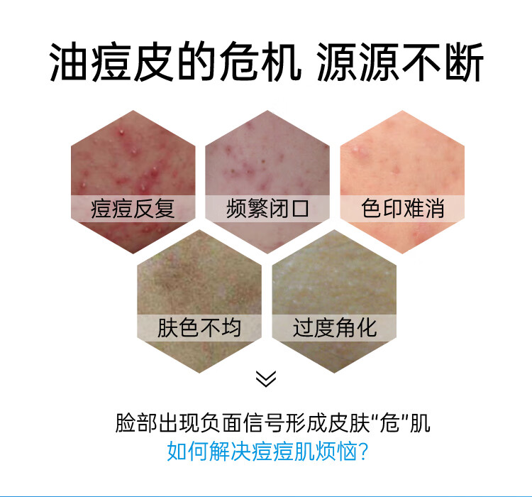 希川科颜 20%高浓壬二酸焕颜精华霜 5g （赠品）