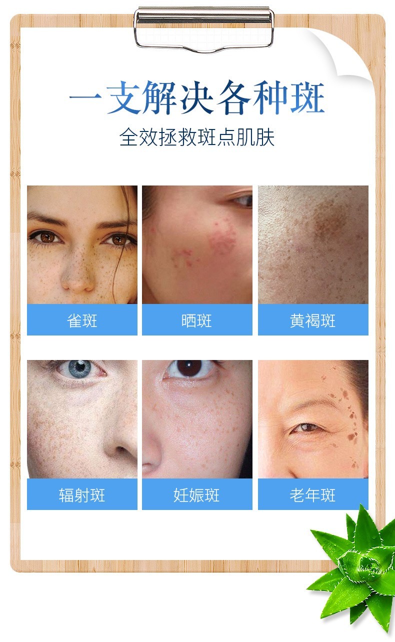 修正凝肌透白淡斑霜2*30g套装 淡化斑点去雀斑黄褐斑妊娠斑祛斑霜