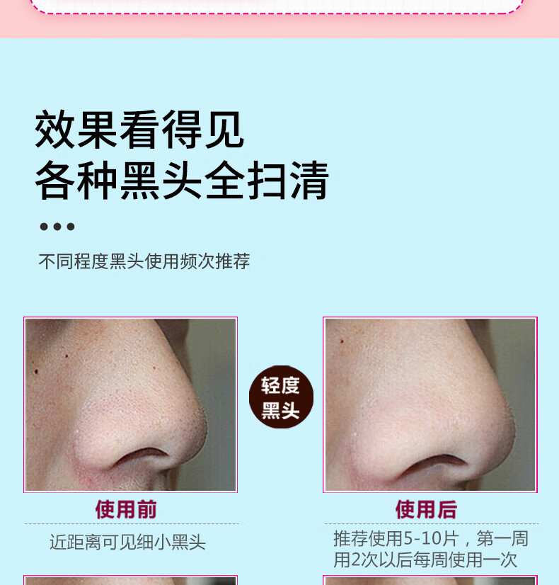 玛贝拉mayllie去黑头鼻贴5p(撕拉式鼻贴膜套装T区护理收缩毛孔男女可用)