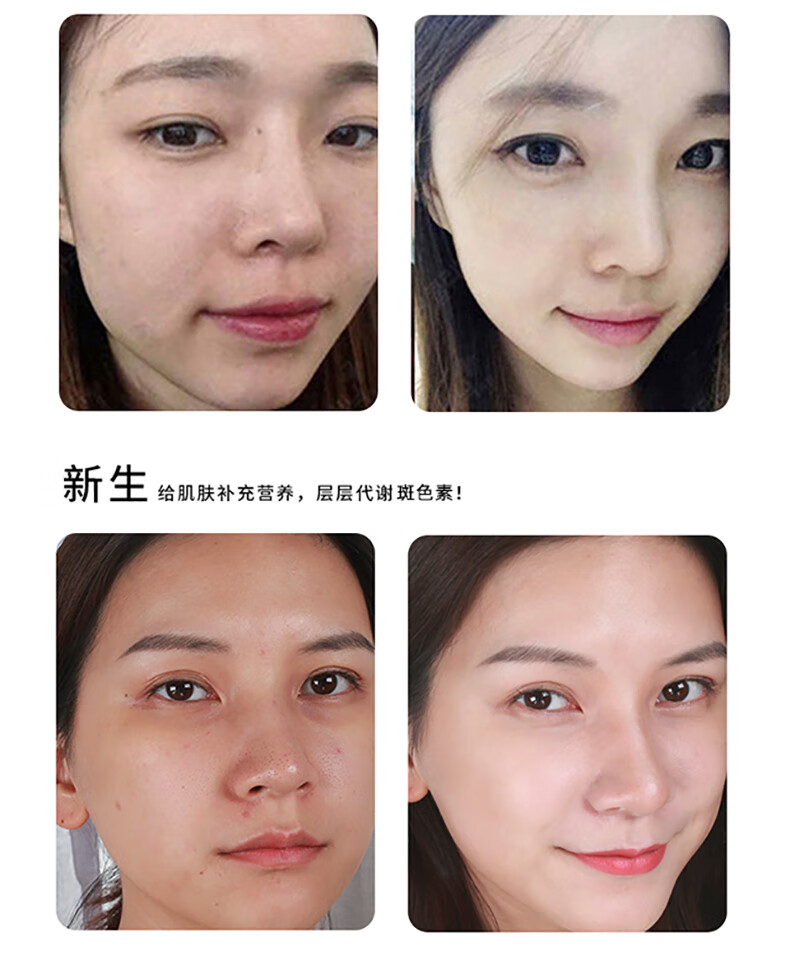 乳安馨正宗贵妇膏懒人遮瑕隔离素颜霜女男美嫩白补水保湿胎盘膏珍珠膏