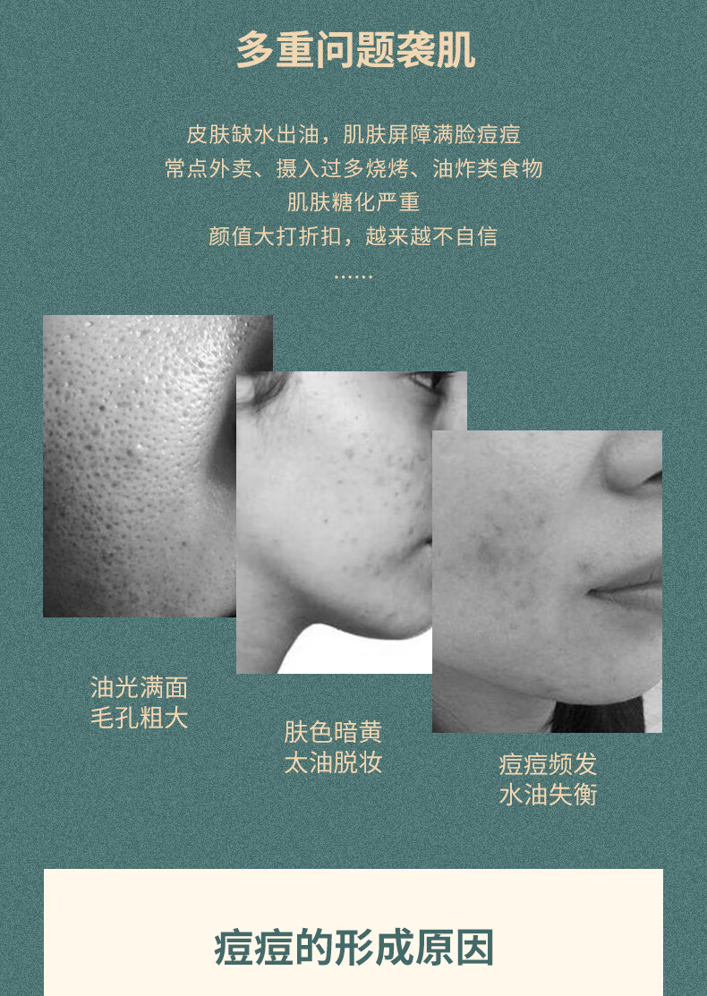 白云山祛痘膏水杨酸淡化痘痘痘坑印子收缩黑头毛孔青春痘闭口粉刺抗痘男女通用30g