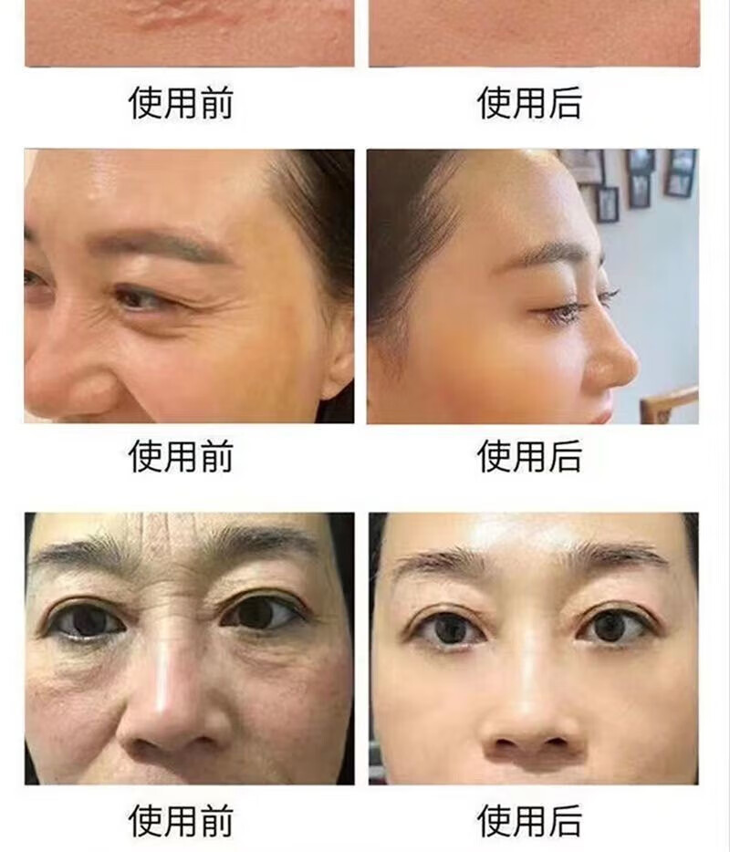 宫本武藏清肌颗粒眼部精华液脂肪粒油脂粒汗管瘤黑眼圈细纹男女士通用30ml