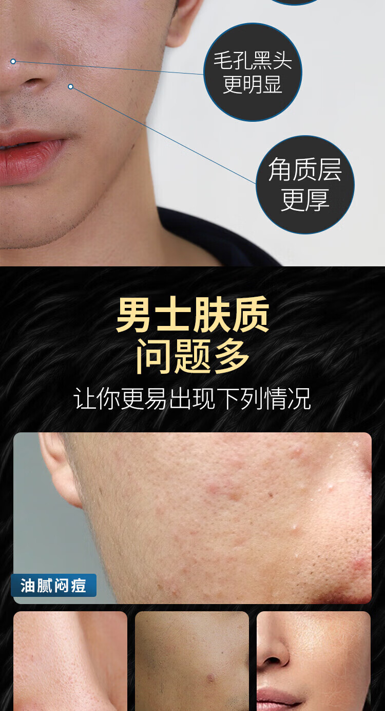 国药精养美白洗面奶氨基酸洁面乳祛斑控油抗痘收缩毛孔保湿清洁男士150ML